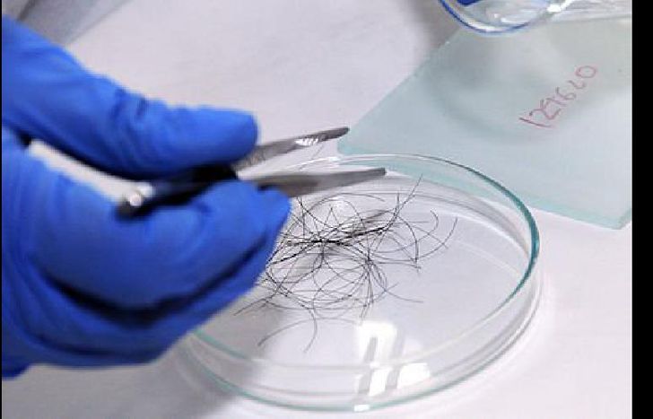 para determinar los niveles de estrés.