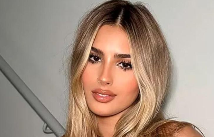 Julieta Poggio se pegó un porrazo.