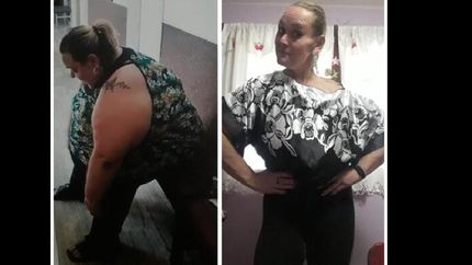 Hoy pesa 75 kilos, pero contó que estuvo cuatro años postrada en una cama por su sobrepeso.