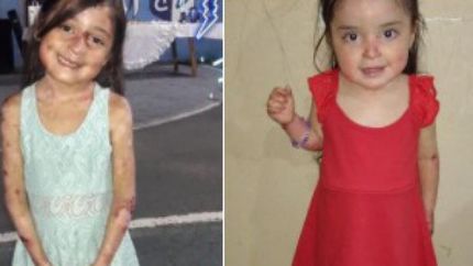 Padecen la misma enfermedad y necesitan ayuda.