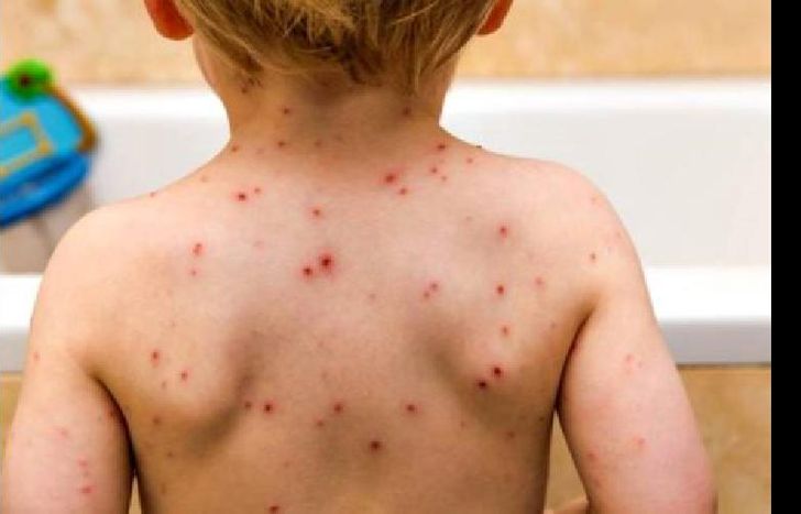 En las provincias argentinas que comparten frontera con Brasil, se están haciendo campañas.