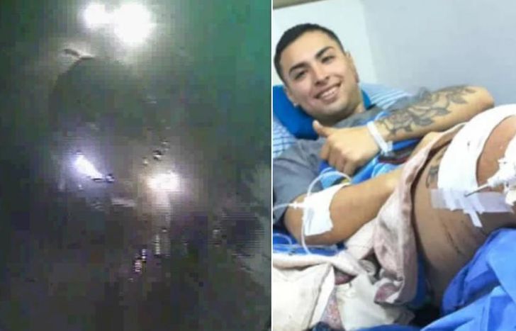 La víctima fue sometida a una cirugía por la grave lesión que sufrió.