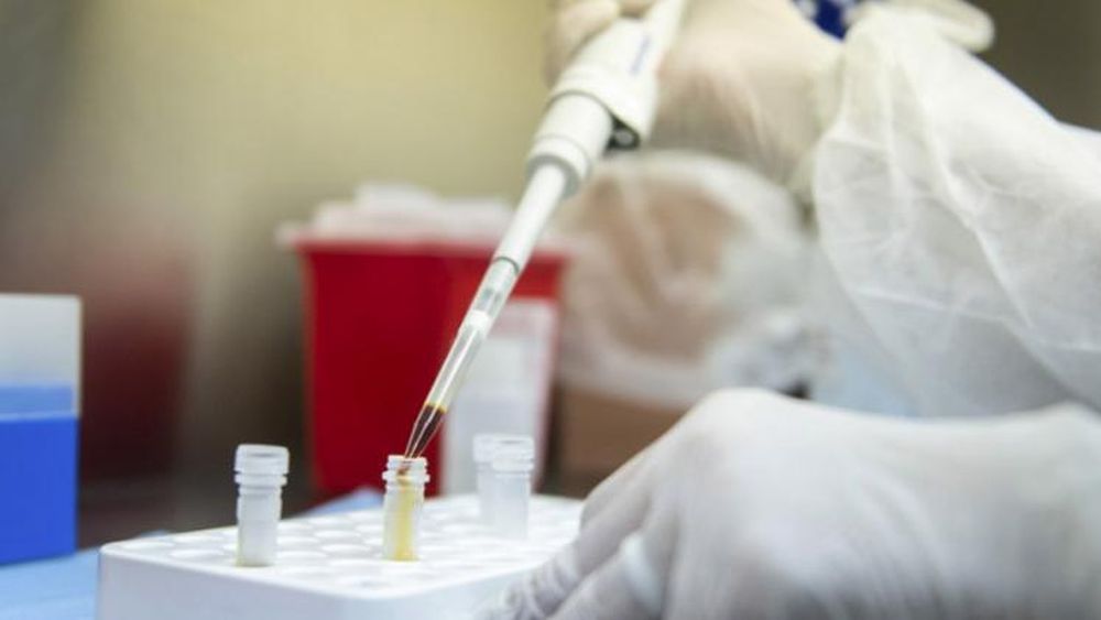 Los resultados surgen del análisis de más de 3 mil muestras.
