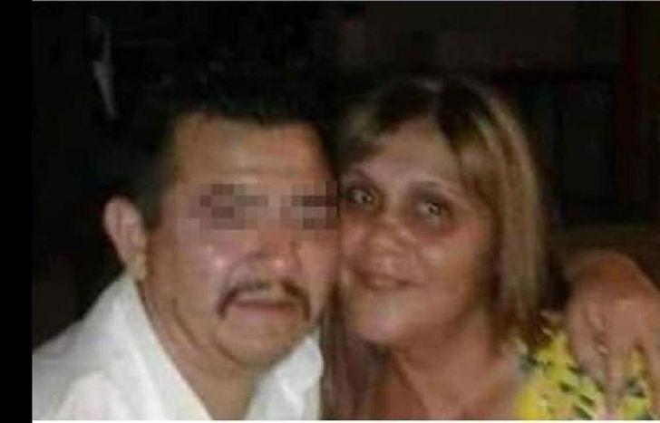 Graciela tenía el 30% del cuerpo comprometido.