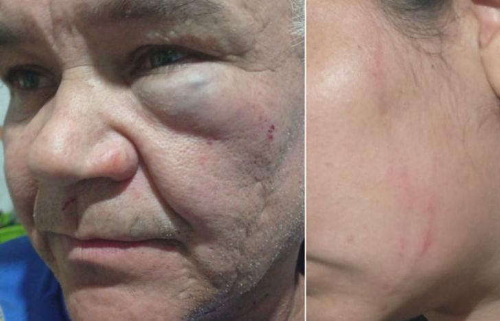 Las lesiones en las caras de las víctimas.