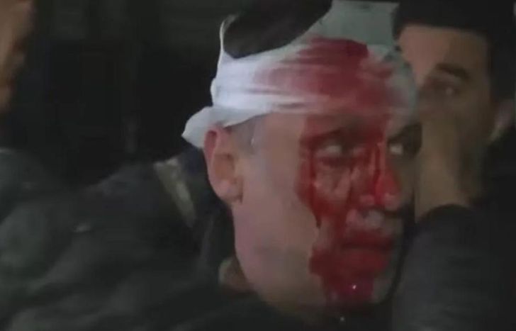 Cristian Mercatante, herido en un acto de Milei.