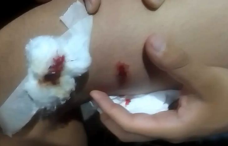 Un joven de Fiorito resultó herido por una bala perdida en Navidad.