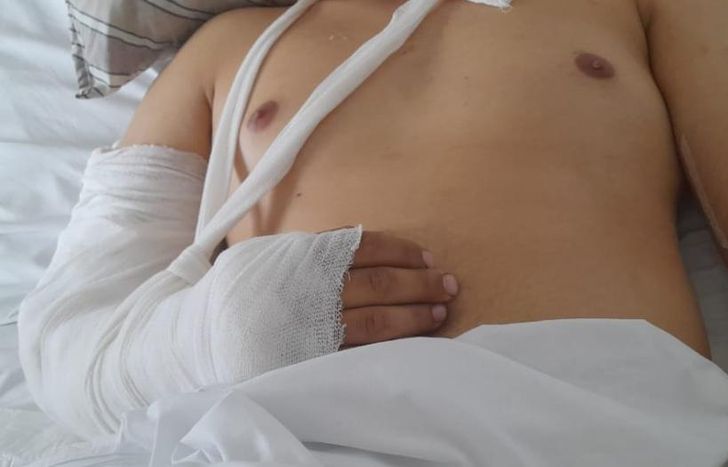 El damnificado estuvo internado en muy grave estado.