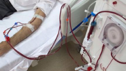 Hay 180 centros de diálisis afectados.
