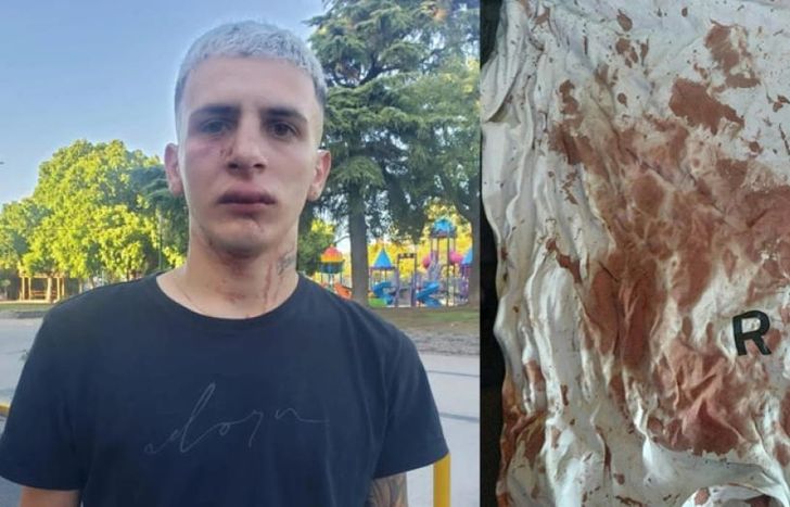 Tomás terminó con la cara hinchada y la ropa llena de sangre.