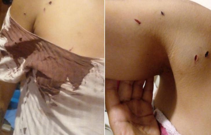 La joven atacada terminó ensangrentada, con golpes en distintas partes del cuerpo.