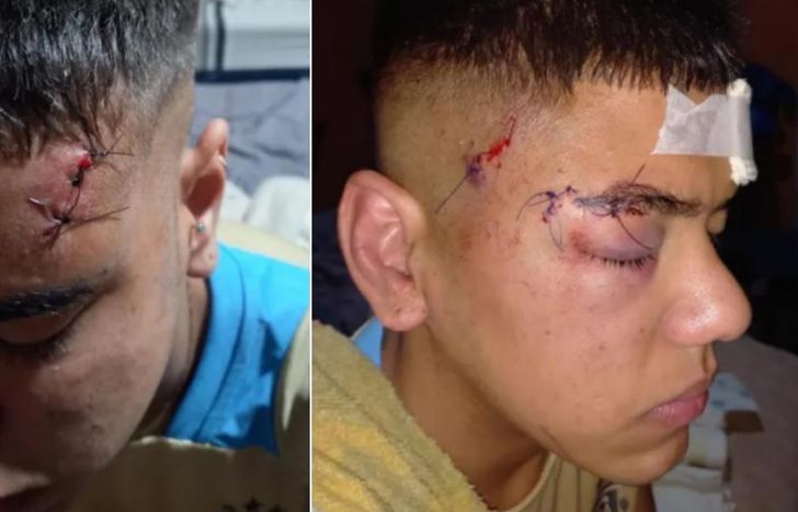 Las graves heridas que sufrió la víctima.