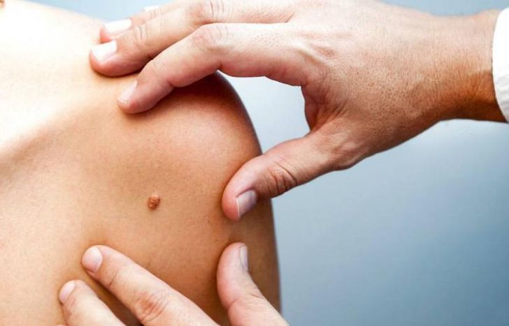 La consulta es totalmente gratuita.