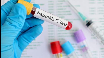 campana hepatitis cero en lomas