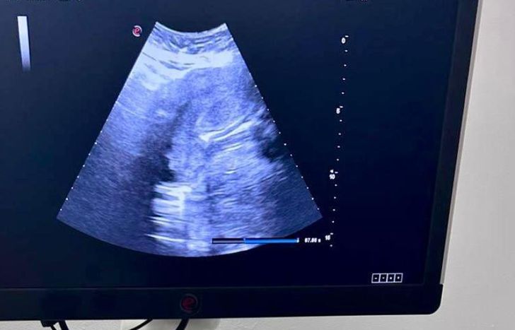 El ecógrafo de alta tecnología ya funciona en el Hospital Materno Infantil Alende de Budge.