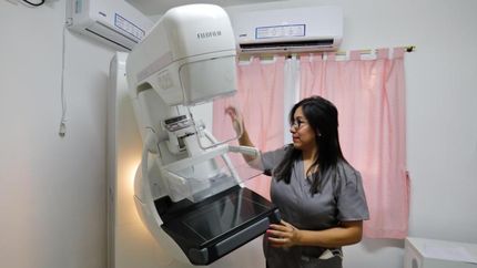 Estos aparatos permiten ver imágenes muy iniciales de un cáncer de mama.