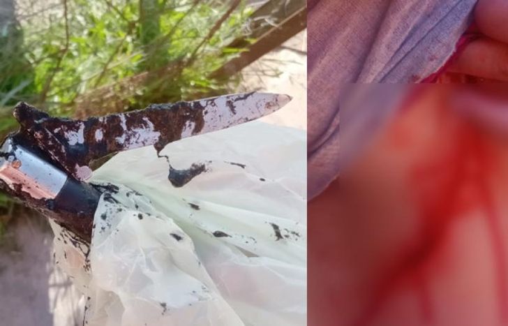 El arma con el que acuchillaron a la víctima y la profunda herida que le causaron.