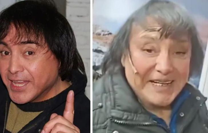 Ricky, tras las supuestas cirugías.