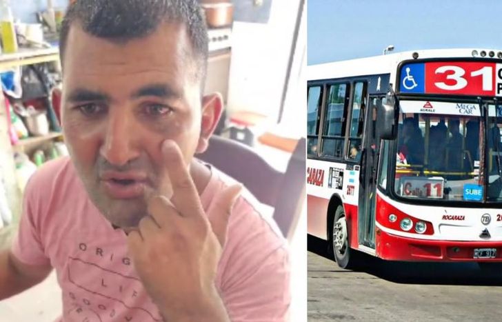 Ramoncito mostró la marca del golpe en la cara.