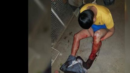 un delincuente fue atacado por un pitbull cuando entro a una casa para robar