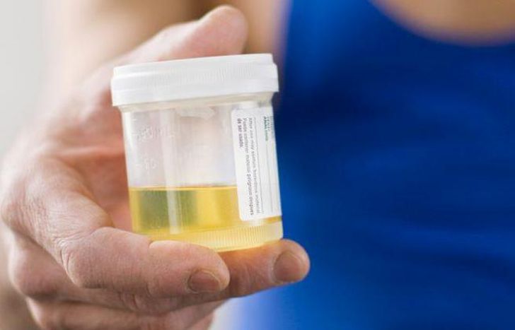 de mujeres embarazadas o mayores de 48 años.