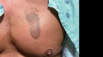 ¡bienvenido dionisio!