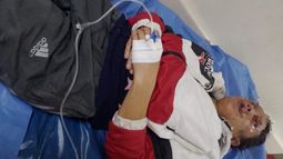 La víctima presentaba lesiones en diferentes partes del cuerpo.