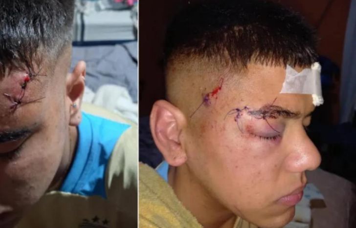 Thomás Fernández recibió varios puntos de sutura por la salvaje agresión.