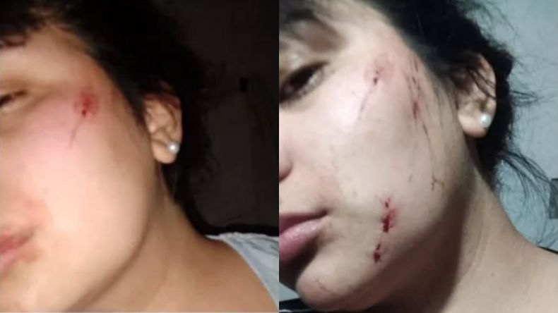 Las marcas en el rostro de la víctima del grave caso de violencia de género.