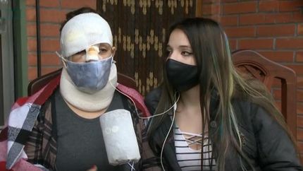Natalia tiene golpes en la cabeza, la nariz y sufre desmayos.