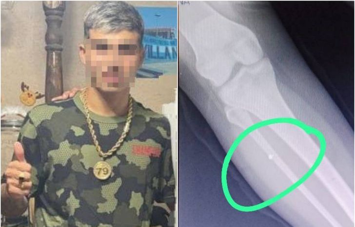 La hermana de Joaquín Castillo recibió cuatro disparos.