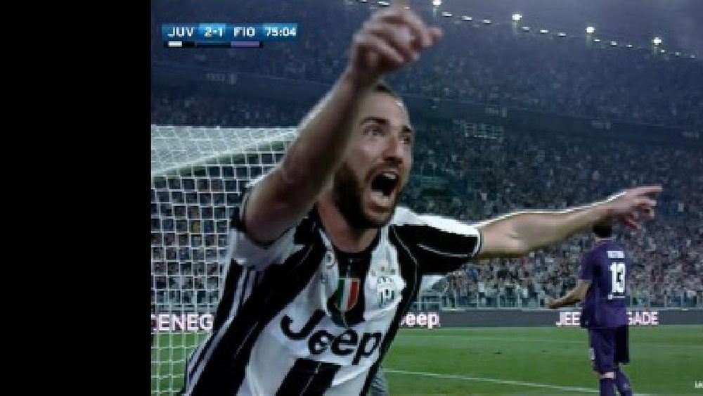 Higuaín será operado de una mano y no jugará para Juventus la próxima fecha