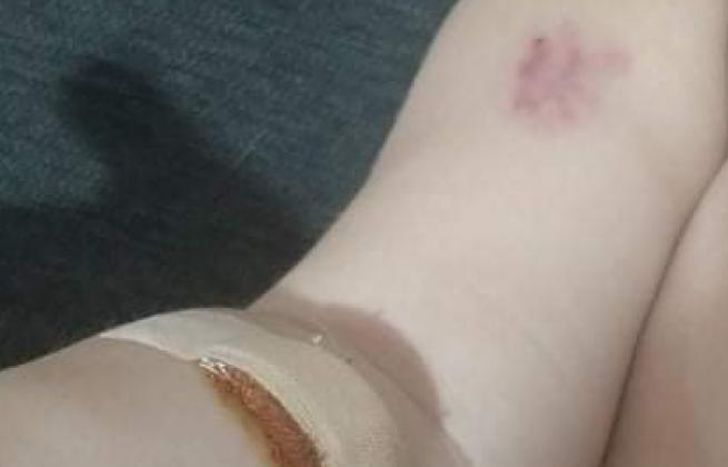 Así quedó el pequeño.