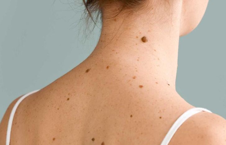 Es necesario saber para prevenir.