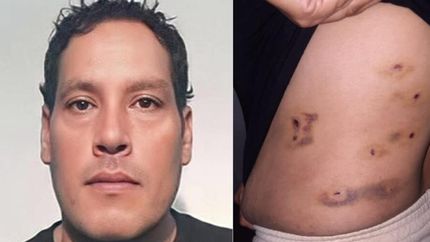 Intentó matar a su expareja a puñaladas.