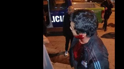 Uno de los pasajeros herido.