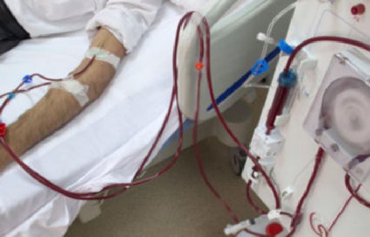 Hay 180 centros de diálisis afectados.