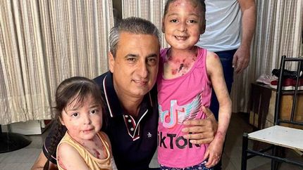 Colaboraron con las hermanas con piel de cristal.