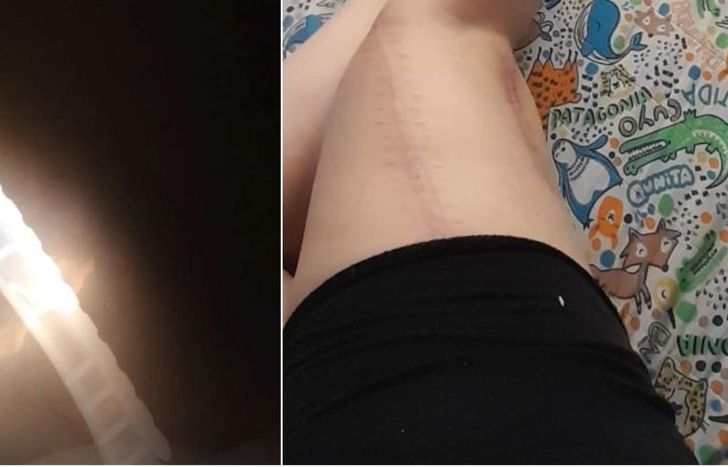 La damnificada padece una discapacidad tras el ataque.