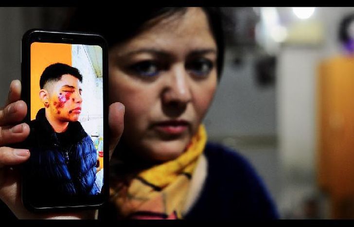 Marina Candia muestra cómo le quedó la cara a su hijo.