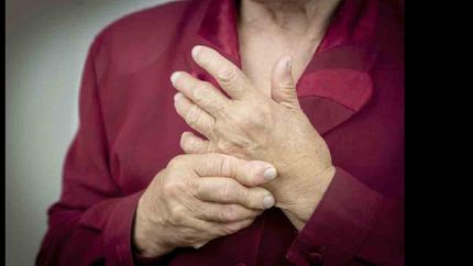 La artritis ya no se considera una enfermedad lenta y progresiva, sino que es abordada como de rápida evolución.