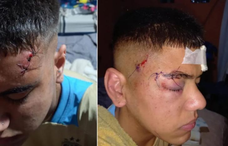 La víctima del ataque en patota sobrevivió, pero recibió varios puntos de sutura.