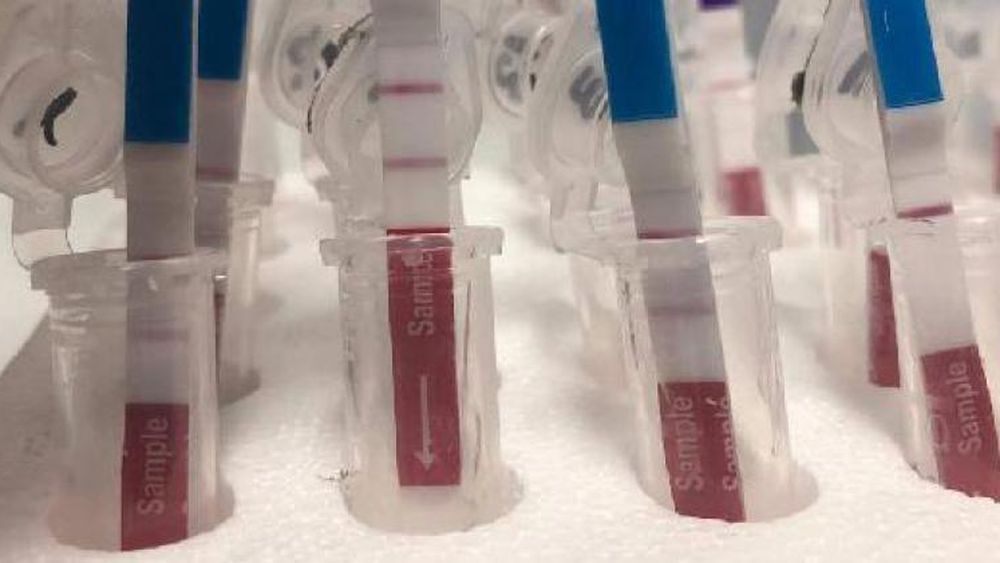 Cómo funciona la unidad de monitoreo y de la donación de plasma