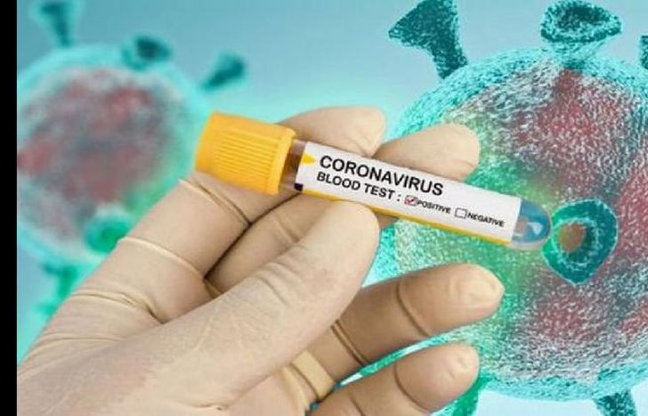 Del total de contagios, 28.732 (44,5%) son casos de circulación comunitaria.