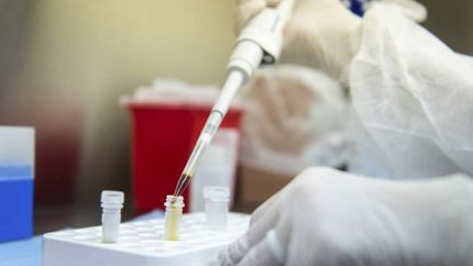 Los resultados surgen del análisis de más de 3 mil muestras.