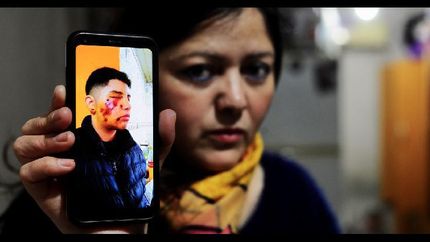 Marina Candia muestra cómo le quedó la cara a su hijo.