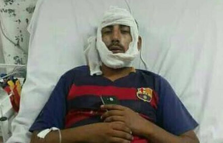 El joven ya fue dado de alta, pero deberá operarse.