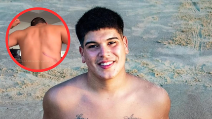 Thiago Medina accedió a mostrar las marcas que le dejaron en el cuerpo el accidente en moto. Thiago Medina accedió a mostrar las marcas que le dejaron en el cuerpo el accidente en moto.